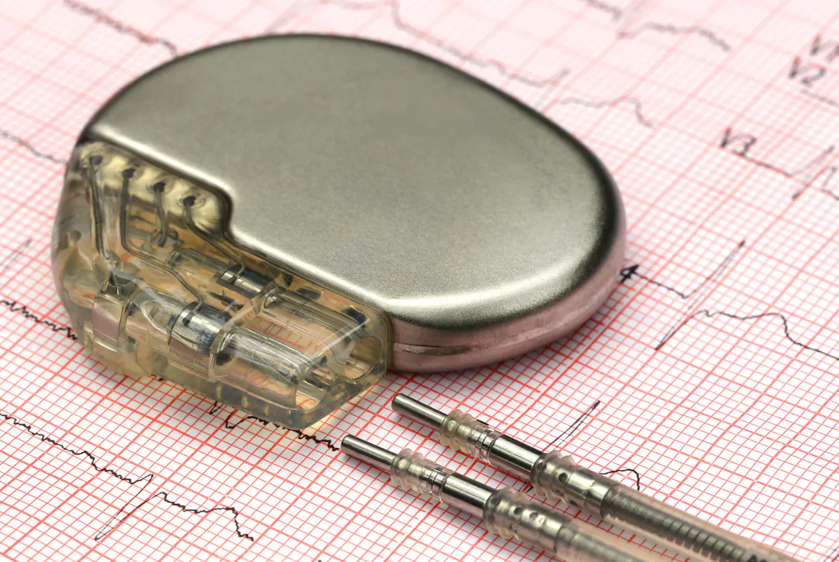 Benefits of Pacemaker Implantation
